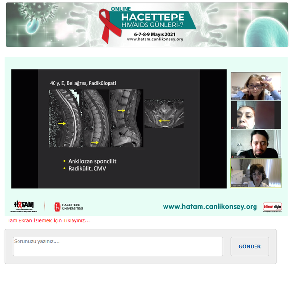 BİLİMSEL BİLİŞİM E-KONGRE MODÜLÜ ile online olarak gerçekleştirilen “HACETTEPE HIV/AIDS GÜNLERİ-7” toplantısının 2. paneli Doç. Dr. Ahmet Çağkan İNKAYA’nın moderatörlüğünde, Prof. Dr. Meryem Aslı TUNCER ve Prof. Dr. Kader KARLI OĞUZ’un “HIV İnfekte Hastaların Nöroradyolojik Değerlendirmesi”, Dr. Öğr. Üyesi İrem YILDIZ’ın ise “HIV İnfekte Hastaların Psikiyatrik Değerlendirmesi” başlıklı sunumları ile gerçekleşti.
Katılımcılarımız ve konuşmacılarımıza toplantımızın 2. gününde aktif görüntülü katılımları nedeniyle teşekkür ederiz.
www.hatam.canlikonsey.org
www.hivpozitifve.org